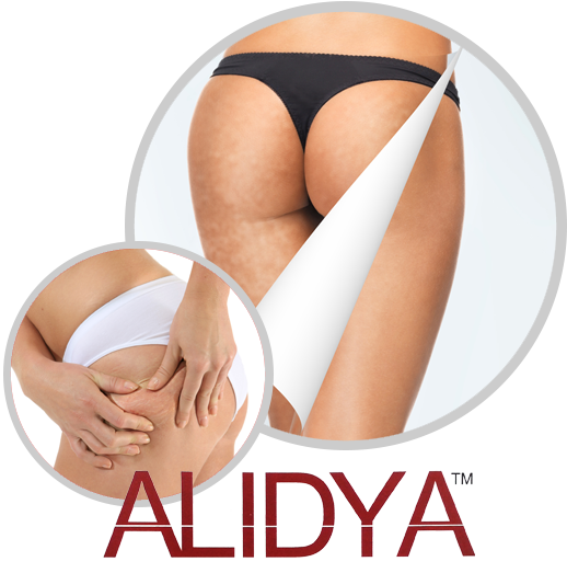 alidya